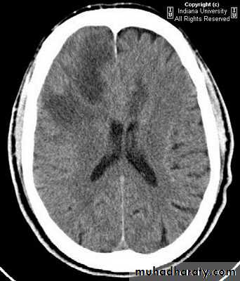 Neurosurgery