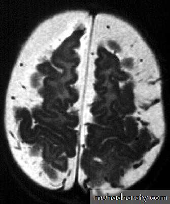 Neurosurgery