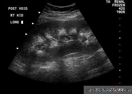 parathyroid