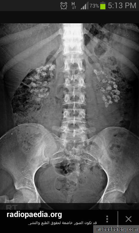 parathyroid