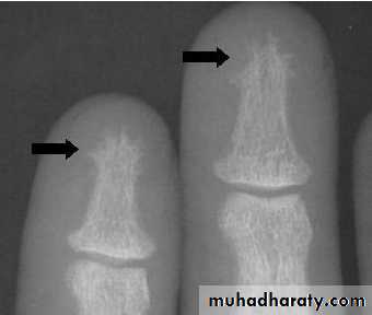 parathyroid