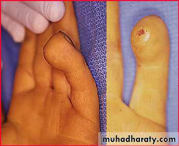 clinical surgery