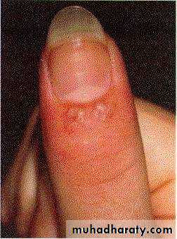 clinical surgery