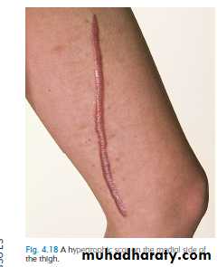 clinical surgery