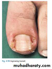 clinical surgery