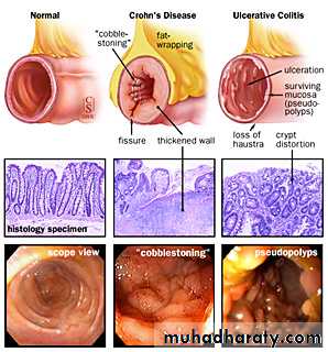 large bowel