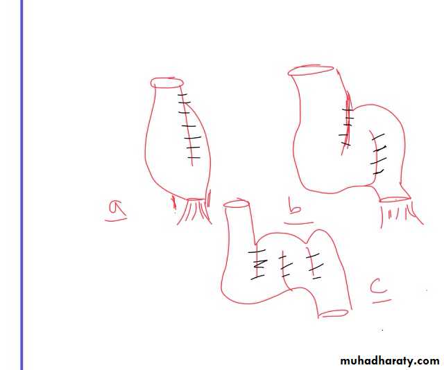 large bowel