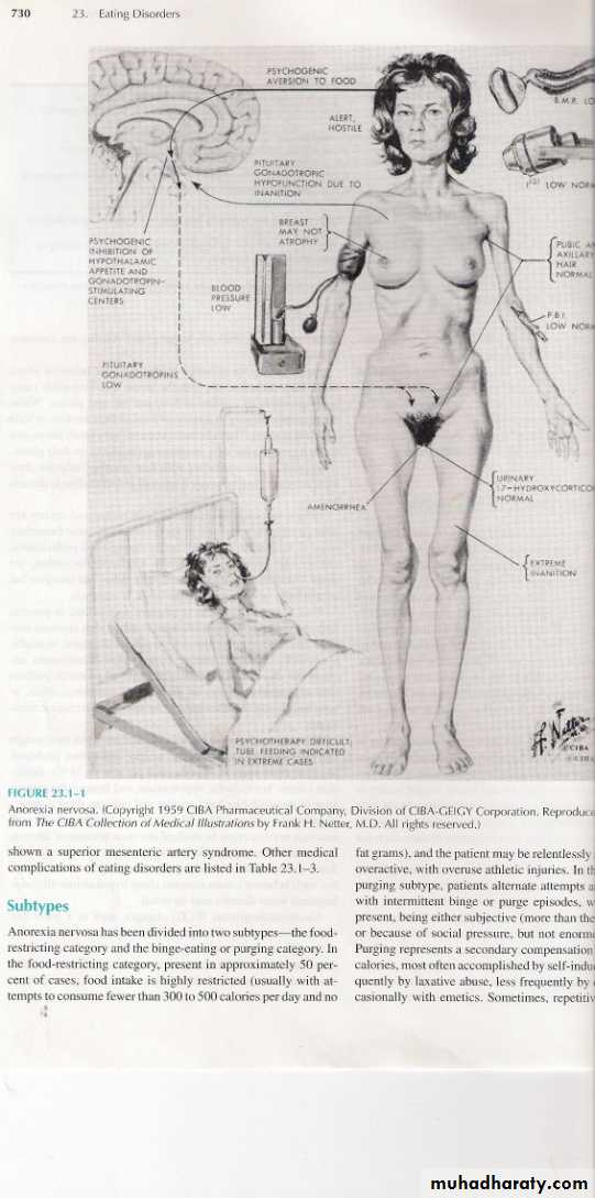 Eating Disorders
