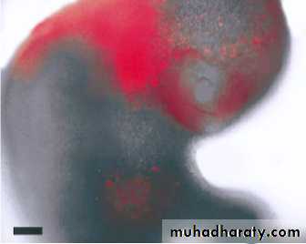 Embryology of the Head