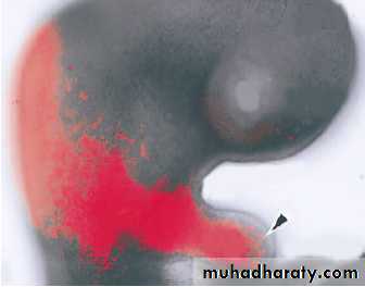 Embryology of the Head