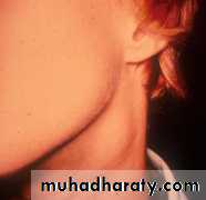 Embryology of the Head