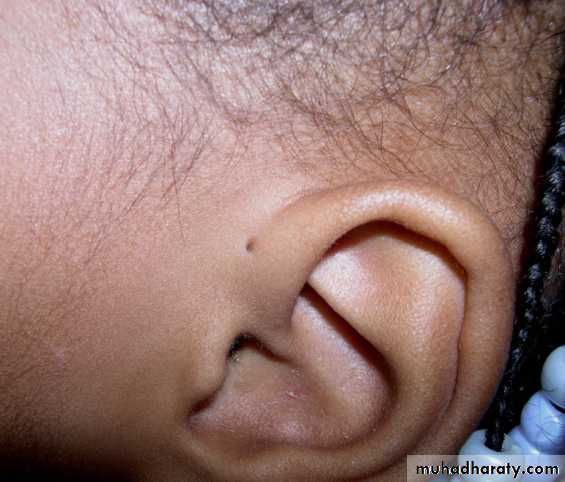 Embryology of the Head