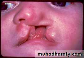 Embryology of the Head