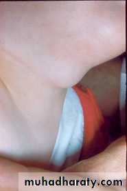 Embryology of the Head