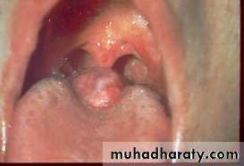 Embryology of the Head