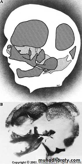 Embryology of the Head