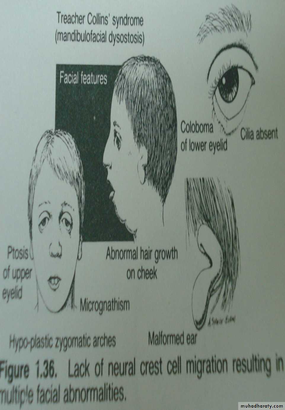 Embryology of the Head