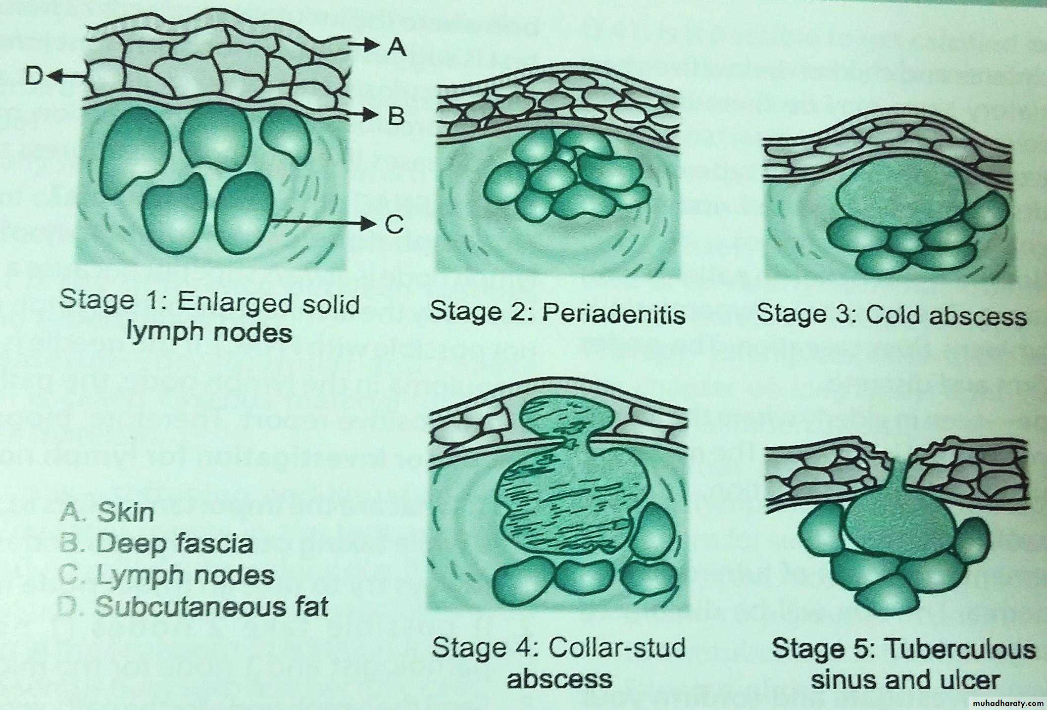 Cervical Lymph Nodes