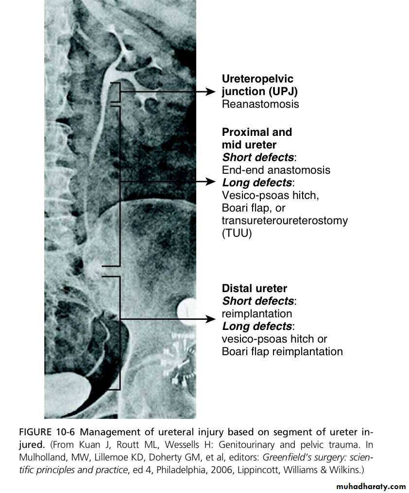 Renal trauma