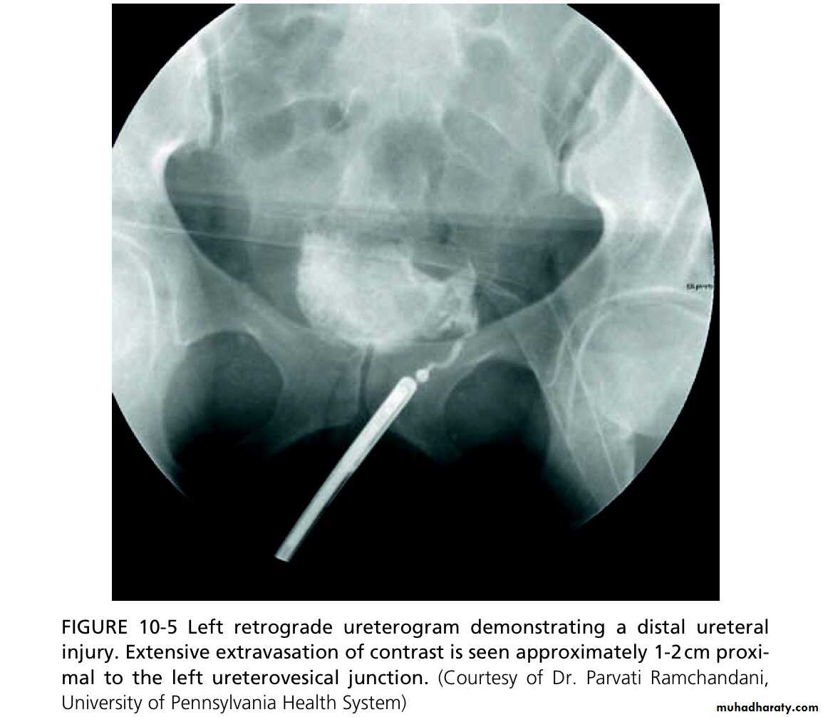 Renal trauma