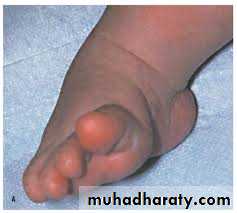 Foot