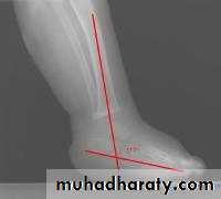 Foot
