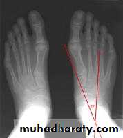 Foot