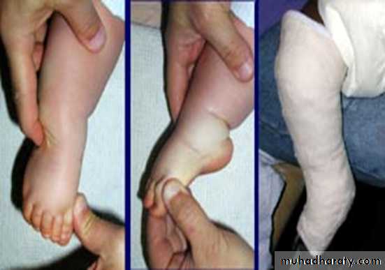 Foot