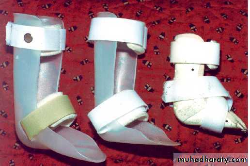 Foot