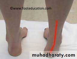 Foot