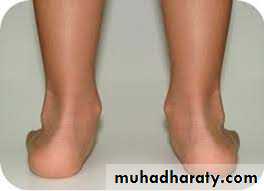 Foot