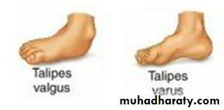 Foot