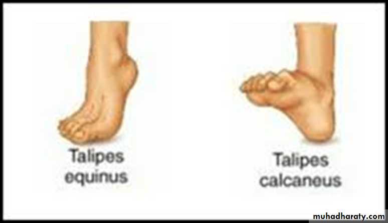 Foot