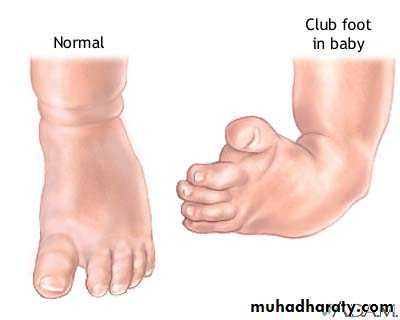 Foot