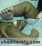 Foot