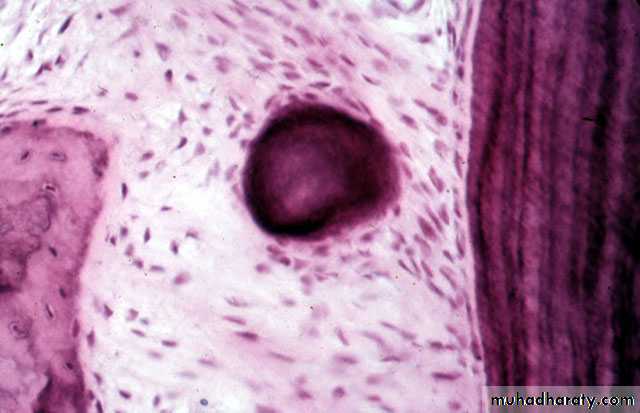 periodental ligament