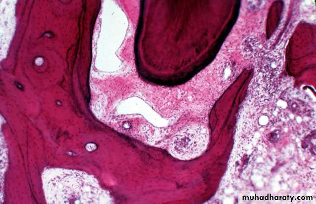 periodental ligament