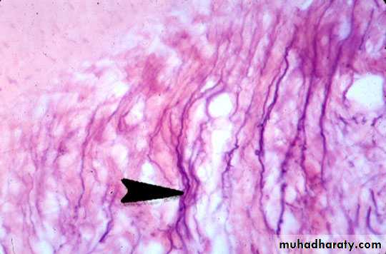 periodental ligament