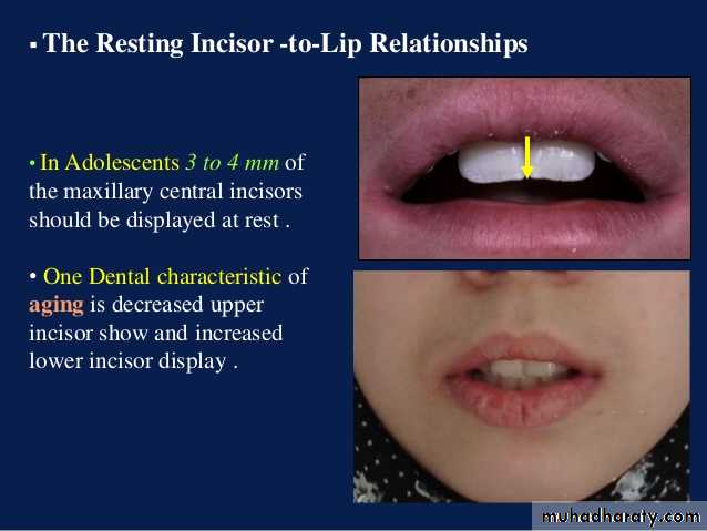 Teeth selection