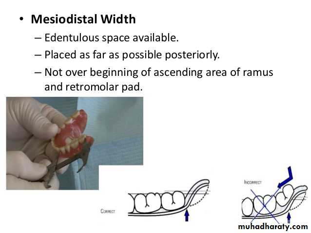 Teeth selection