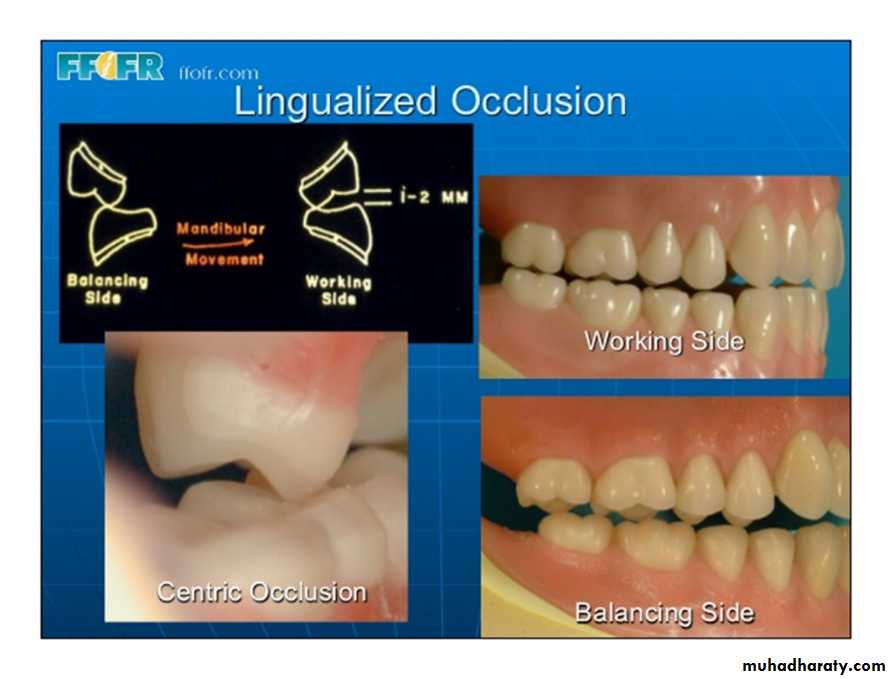 Teeth selection