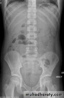 Imaging of GIT diseases