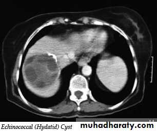 Imaging of GIT diseases