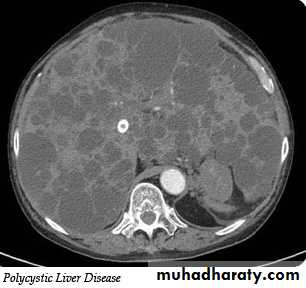 Imaging of GIT diseases