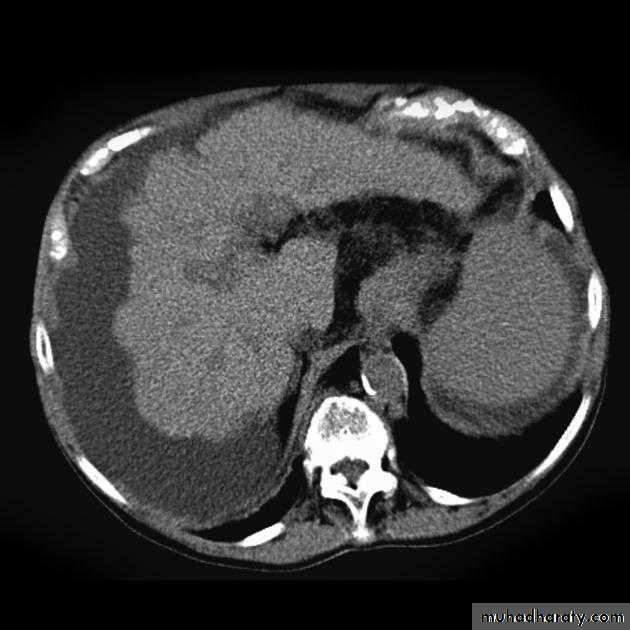Imaging of GIT diseases