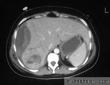 Imaging of GIT diseases