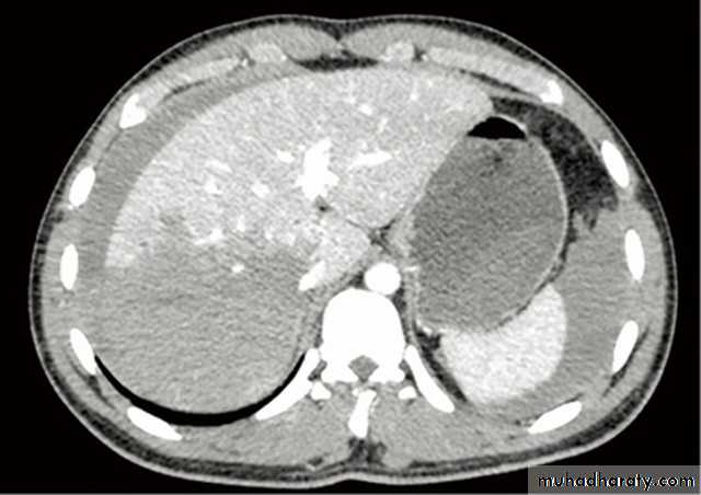 Imaging of GIT diseases