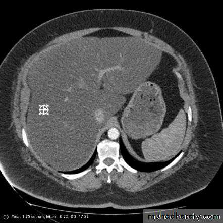Imaging of GIT diseases