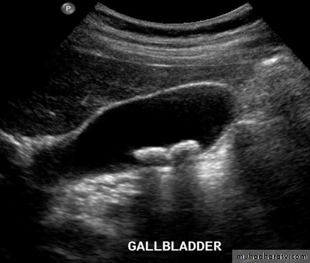 Imaging of GIT diseases