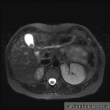 Imaging of GIT diseases